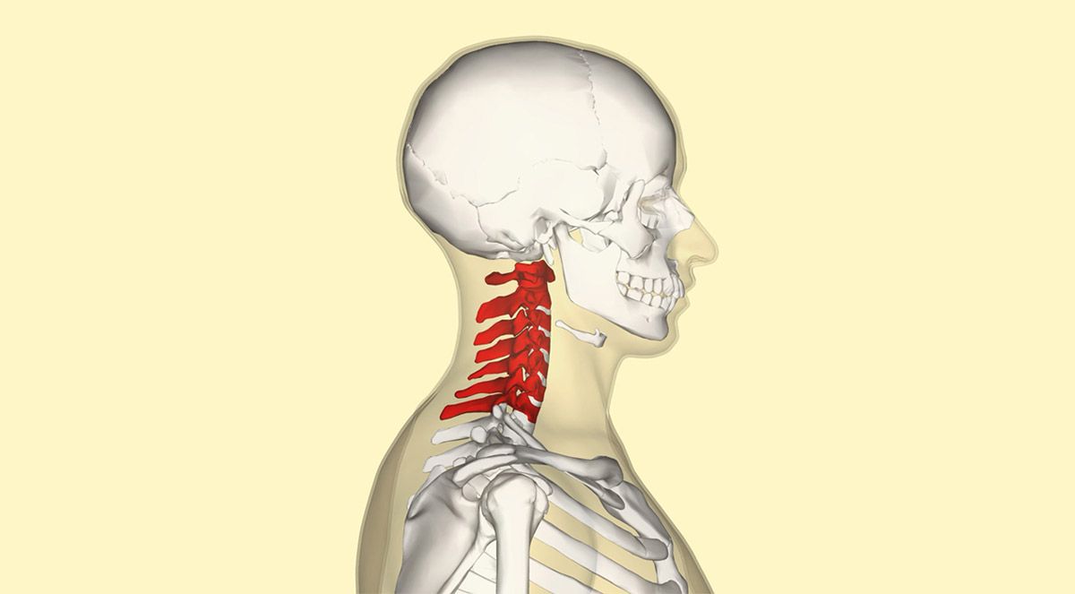 Traumatismo Cervical ¿Qué hacer? - GUÍAS MÉDICA